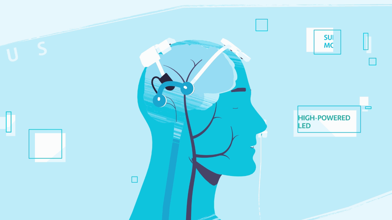 brain stimulation using vielight brain photobiomodulation technology
