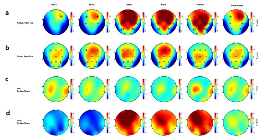 EEG photobiomodulation effects