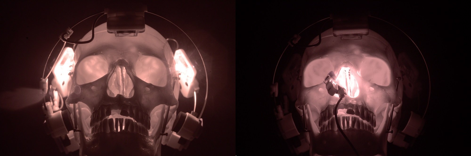 penetration through the skull with near infrared light energy
